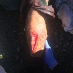 blessure1