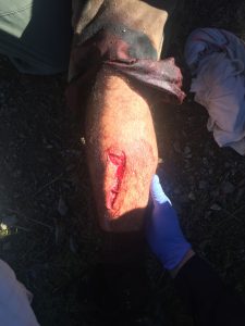 blessure1