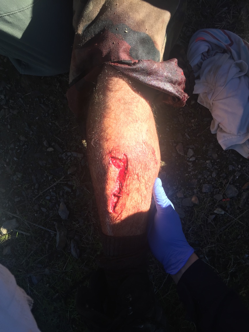 blessure1